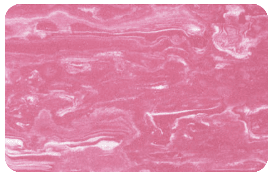 ET-009 - Pink Marbled EVA 35° 3mm